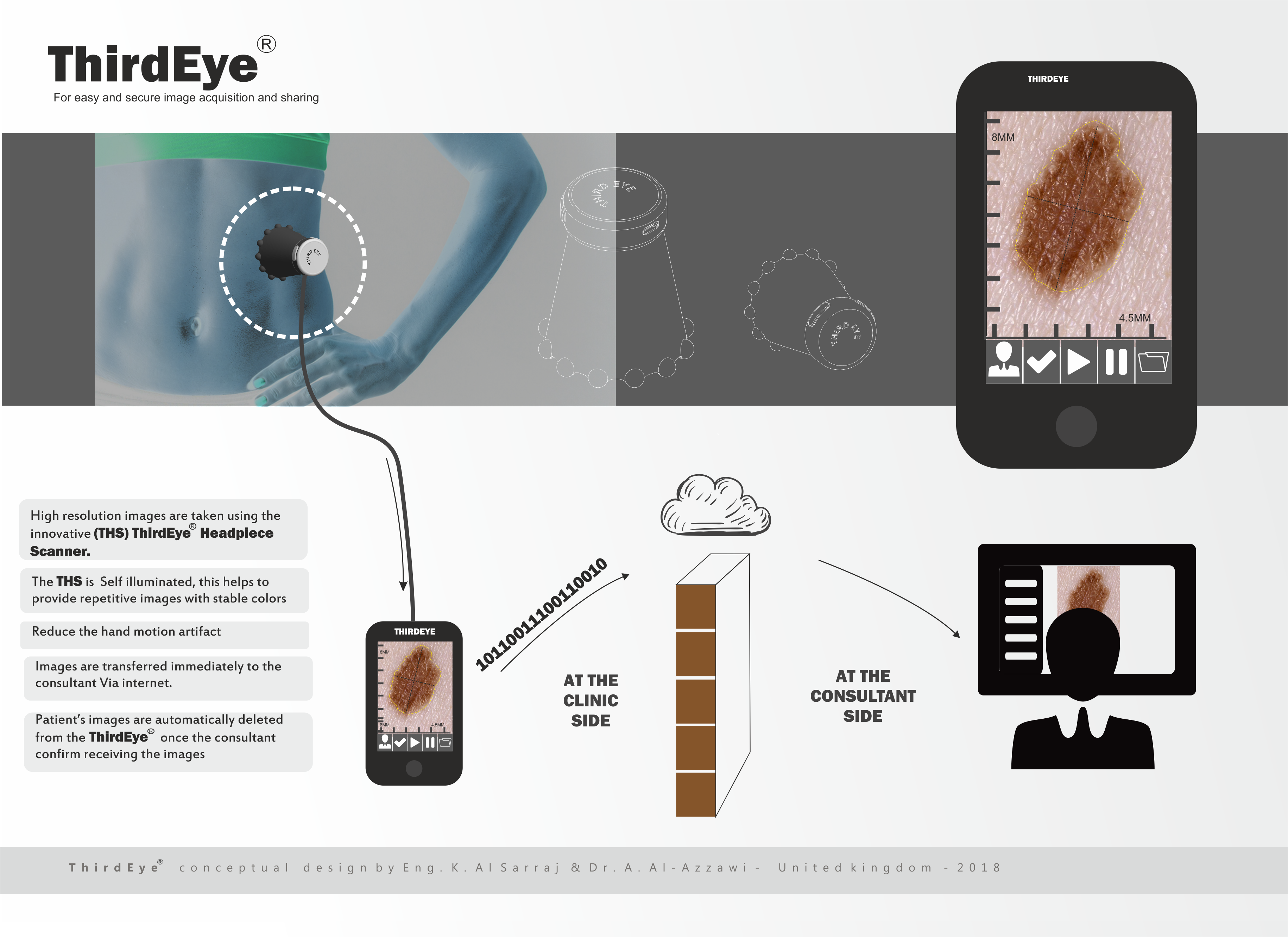 Thirdeye マニュアル: Logicvein Manual – XLBOA